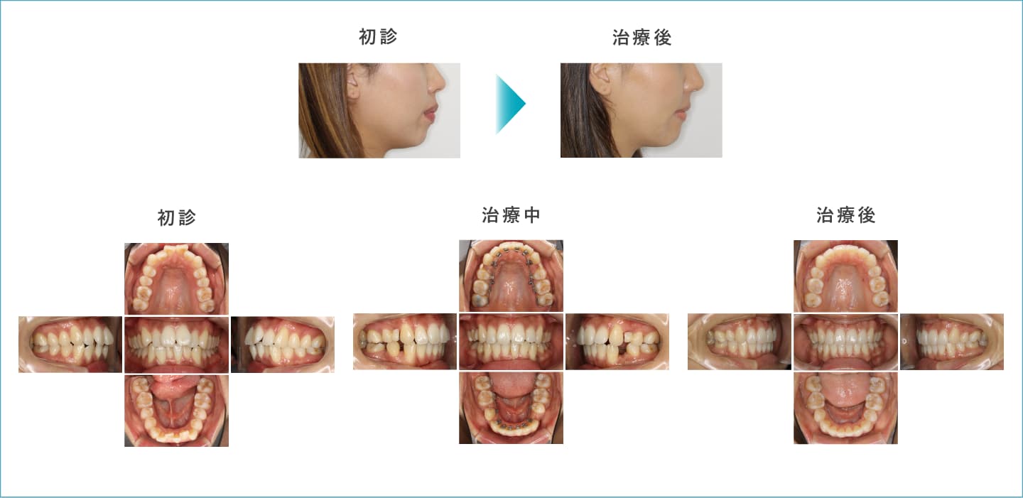 症例写真