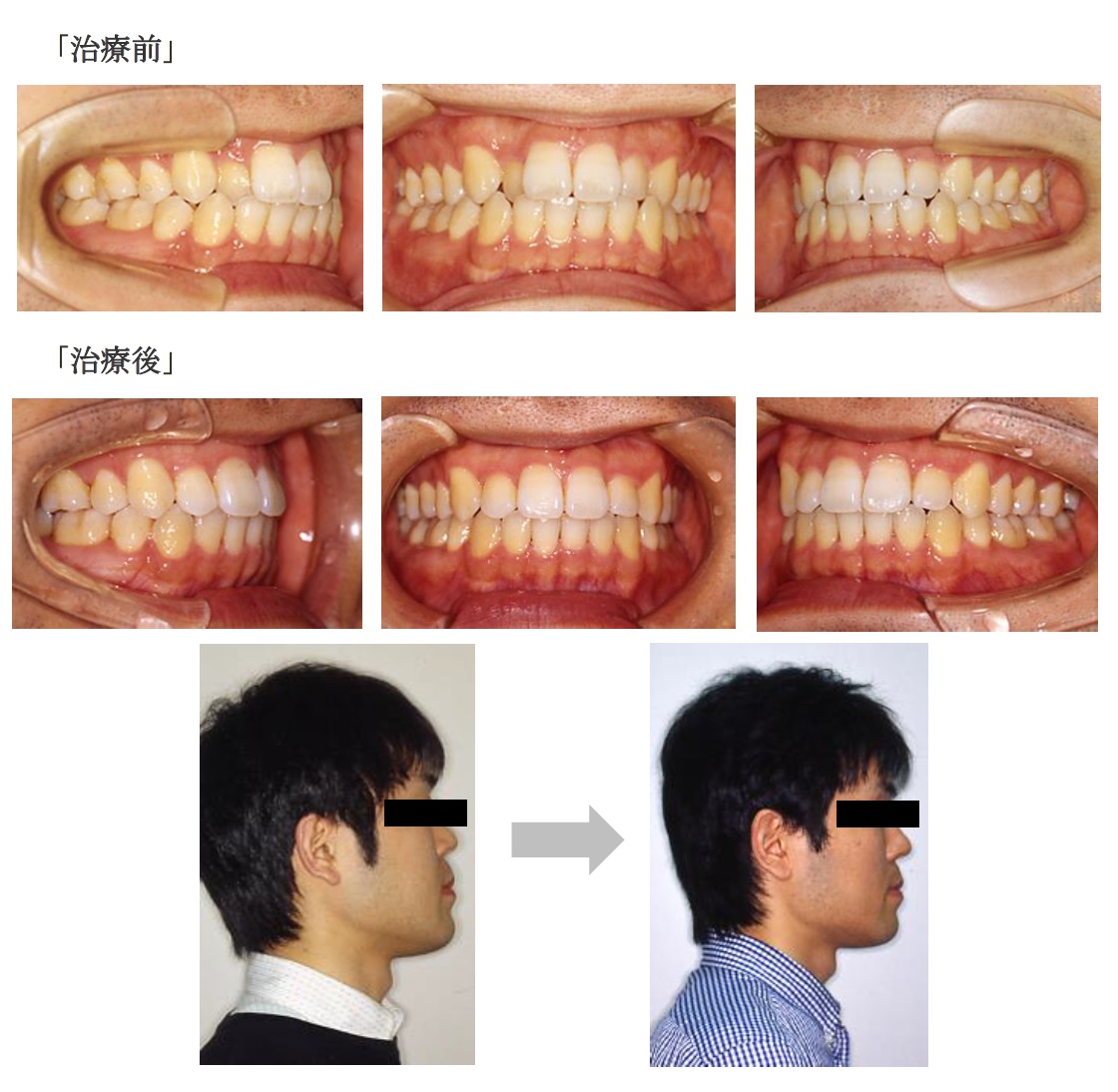 症例写真