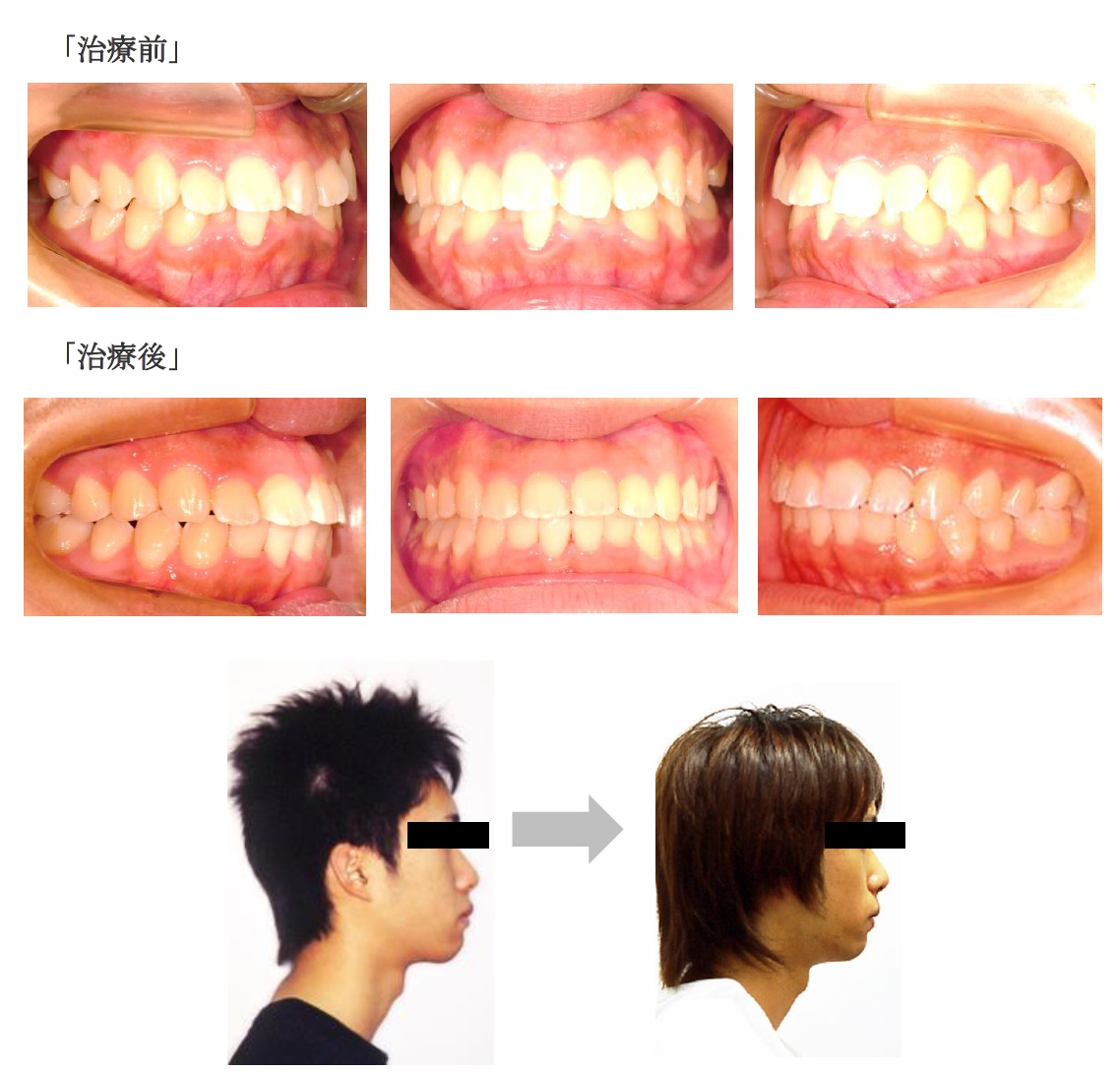 症例写真
