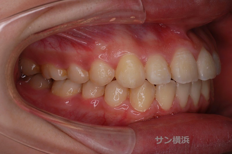 症例写真