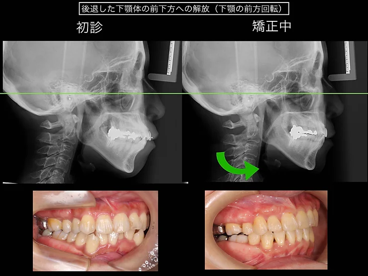 症例写真