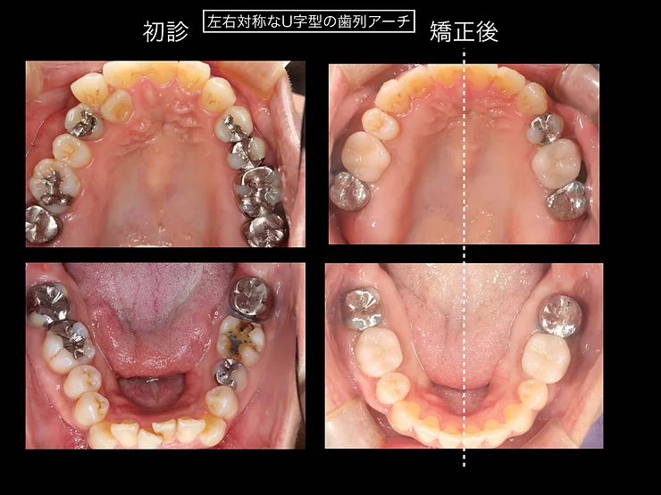 症例写真