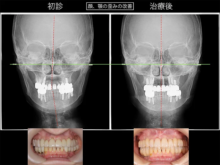 症例写真