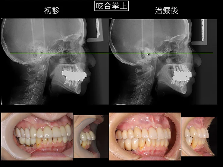 症例写真