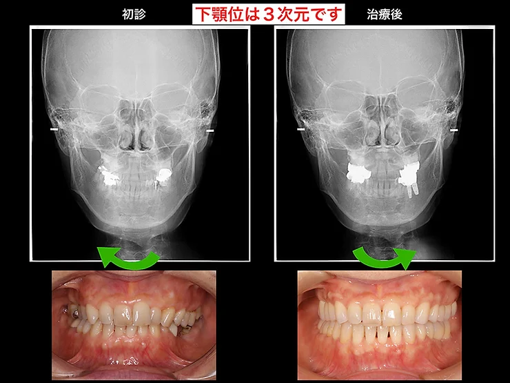 症例写真