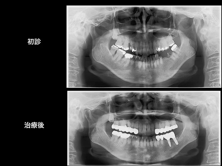 症例写真