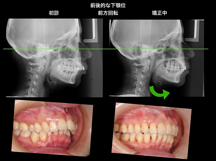 症例写真