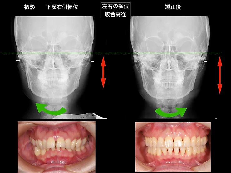 症例写真