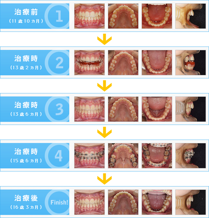 症例写真