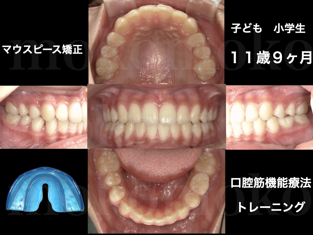 症例写真